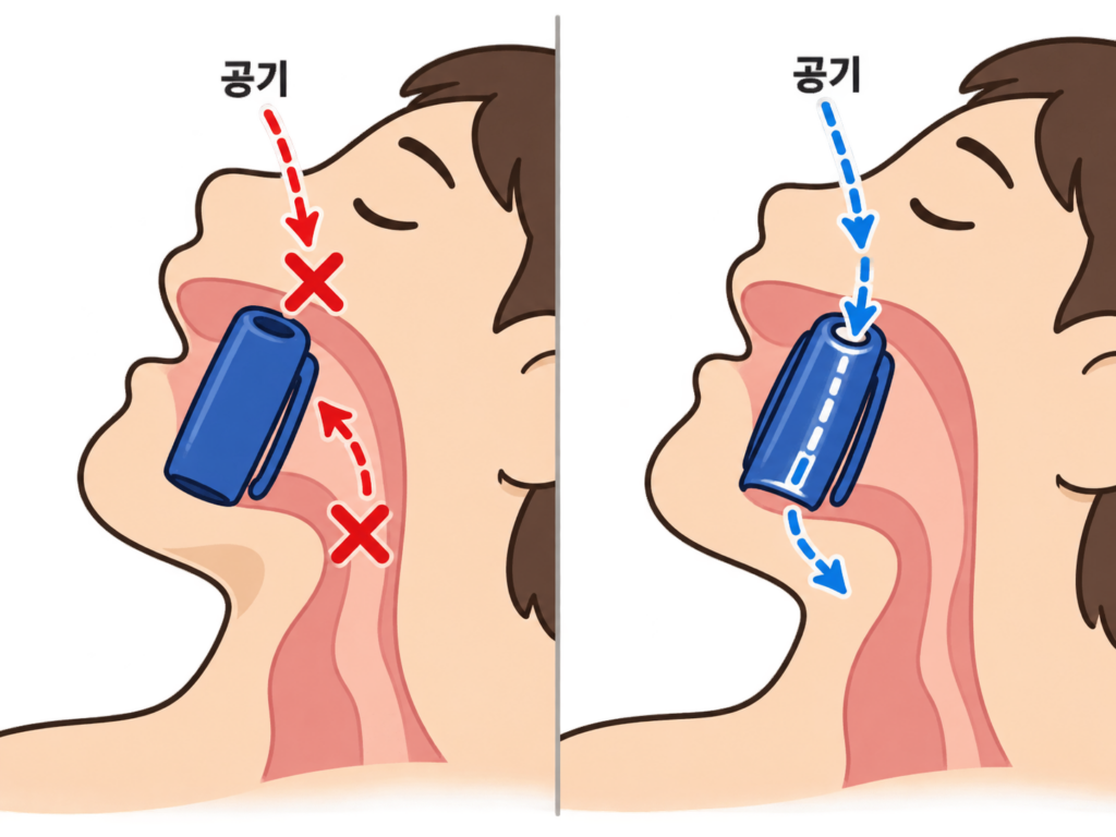 볼펜 뚜껑 구멍, 잉크 때문인 줄 알았는데 설명 도식